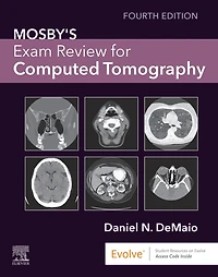 Mosby's Exam Review for Computed Tomography