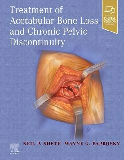 Treatment of Acetabular Bone Loss and Chronic Pelvic Discontinuity