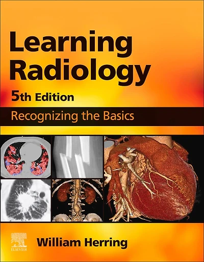 Learning Radiology: Recognizing the Basics