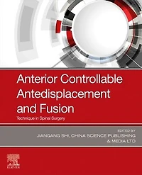 Anterior Controllable Antedisplacement and Fusion: Technique Spinal Surgery