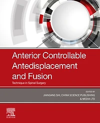 Anterior Controllable Antedisplacement and Fusion: Technique Spinal Surgery