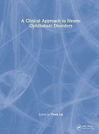 A Clinical Approach to Neuro-Ophthalmic Disorders