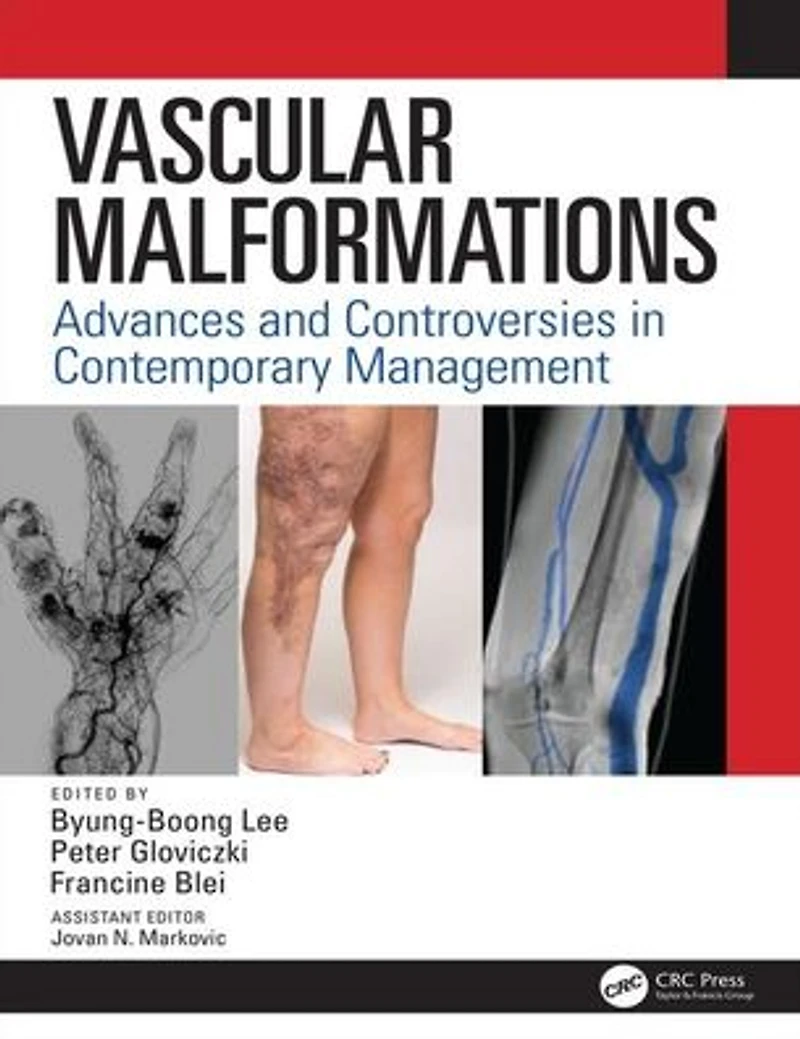 Vascular Malformations: Advances and Controversies Contemporary Management