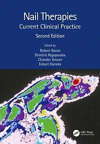 Nail Therapies: Current Clinical Practice