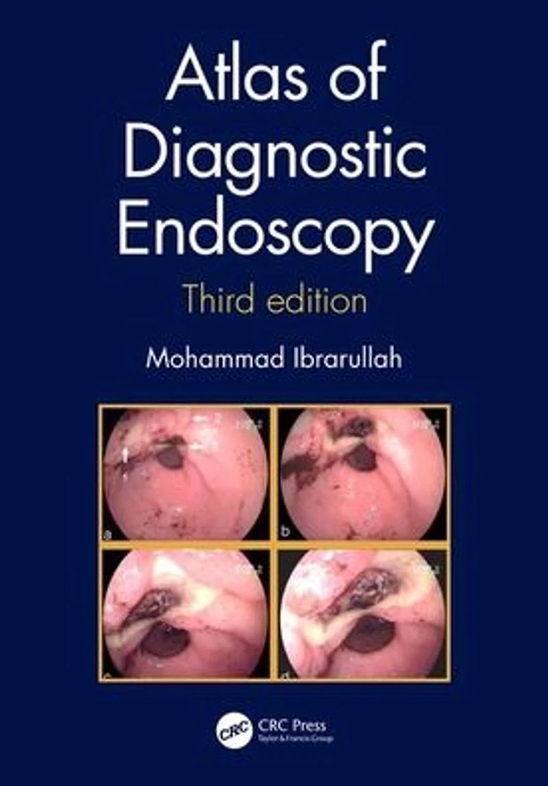Atlas of Diagnostic Endoscopy, 3E