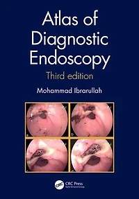 Atlas of Diagnostic Endoscopy, 3E