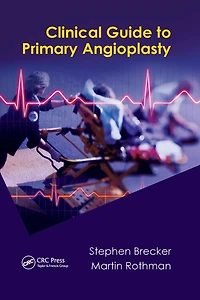 Clinical Guide to Primary Angioplasty