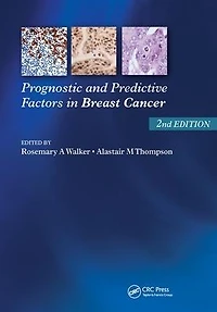 Prognostic and Predictive Factors Breast Cancer