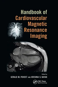 Handbook of Cardiovascular Magnetic Resonance Imaging