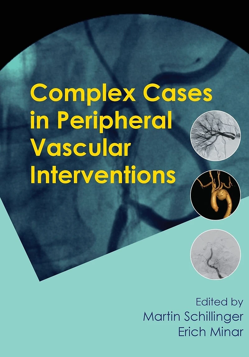 Complex Cases Peripheral Vascular Interventions