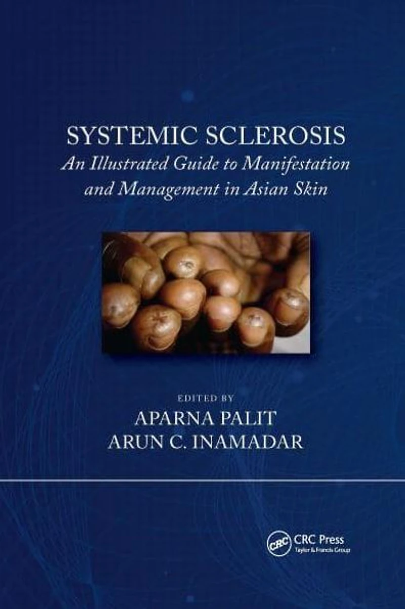 Systemic Sclerosis: An Illustrated Guide to Manifestation and Management Asian Skin