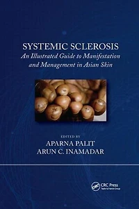 Systemic Sclerosis: An Illustrated Guide to Manifestation and Management Asian Skin