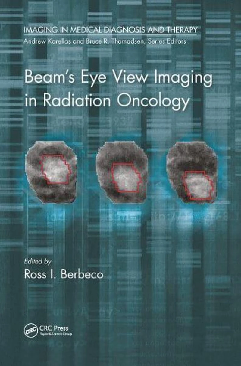 Beam's Eye View Imaging Radiation Oncology