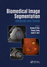 Biomedical Image Segmentation: Advances and Trends