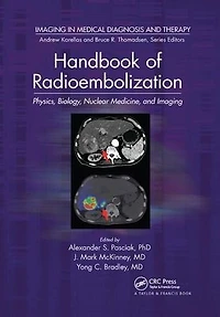 Handbook of Radioembolization: Physics, Biology, Nuclear Medicine, and Imaging
