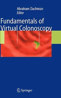 Fundamentals of Virtual Colonoscopy