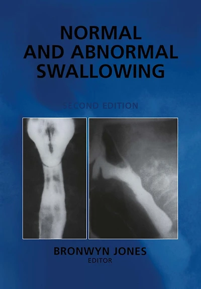 Normal and Abnormal Swallowing: Imaging Diagnosis Therapy