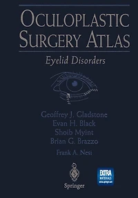 Oculoplastic Surgery Atlas: Eyelid Disorders
