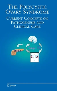 The Polycystic Ovary Syndrome: Current Concepts on Pathogenesis and Clinical Care