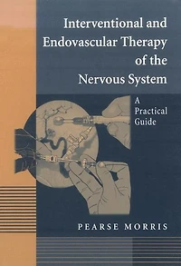 Interventional and Endovascular Therapy of the Nervous System: A Practical Guide