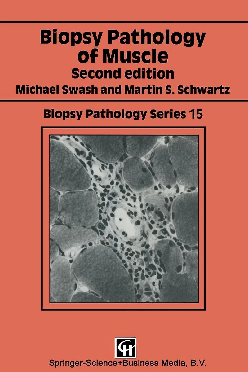 Biopsy pathology of muscle