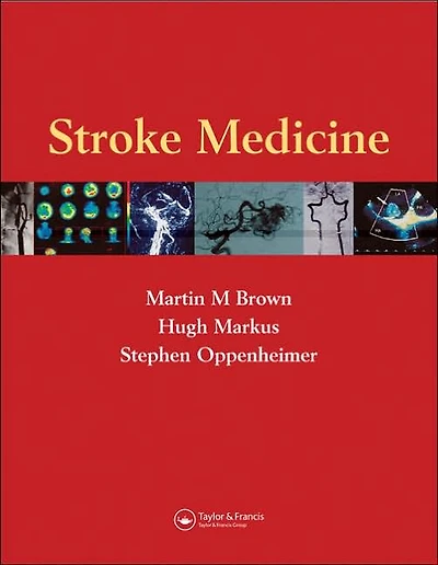 Stroke Medicine