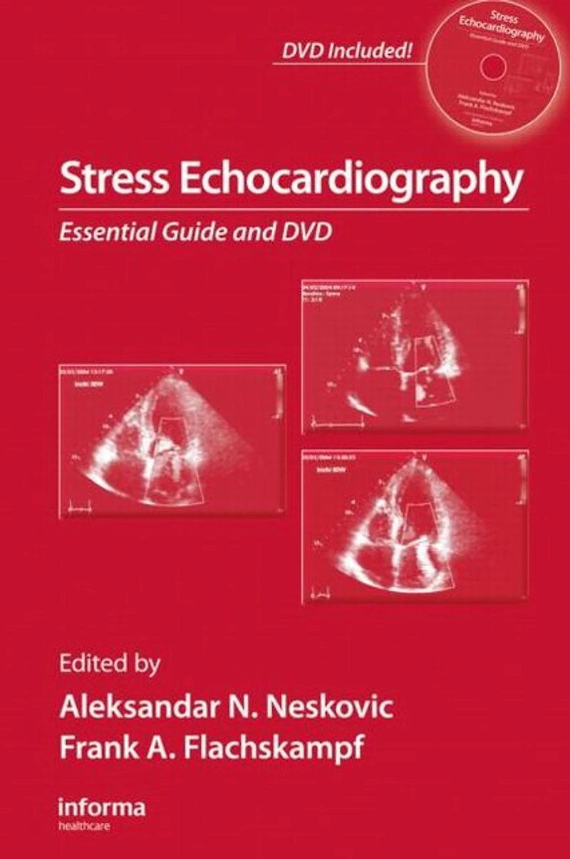 Stress Echocardiography: Essential Guide
