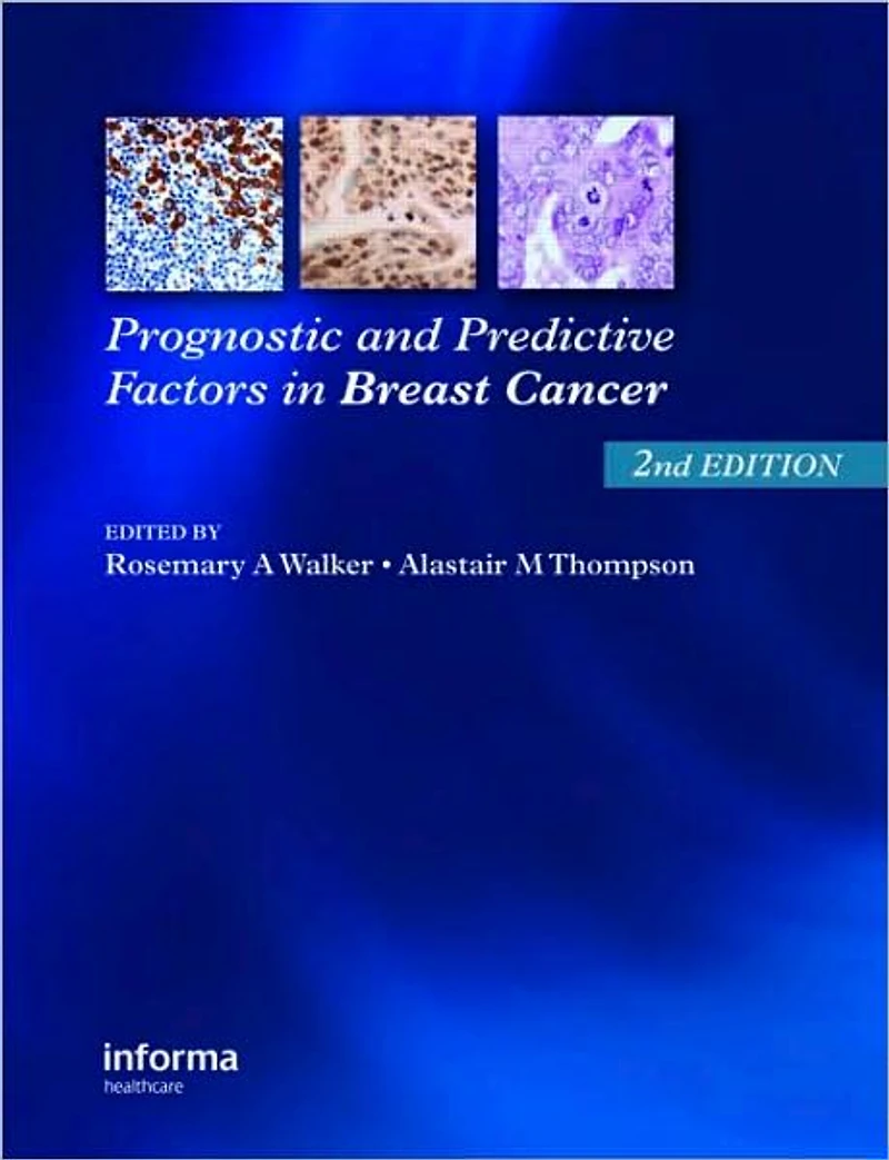 Prognostic and Predictive Factors Breast Cancer