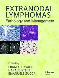 Extranodal Lymphomas: Pathology and Management