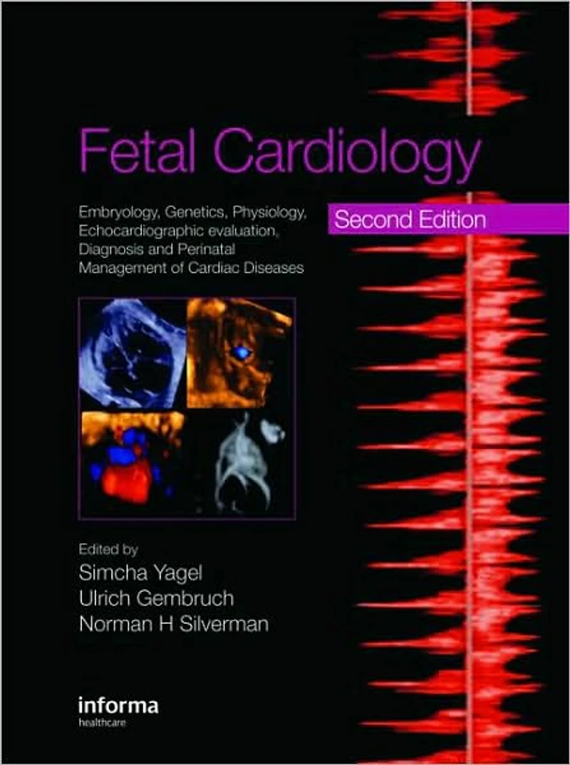 Fetal Cardiology: Embryology, Genetics, Physiology, Echocardiographic Evaluation, Diagnosis and Perinatal Management of Cardiac Diseases