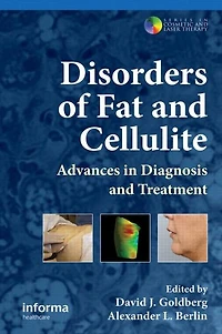 Disorders of Fat and Cellulite: Advances Diagnosis Treatment