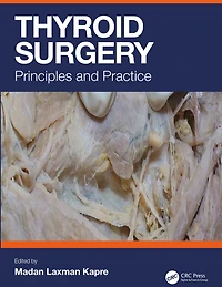 Thyroid Surgery: Principles and Practice