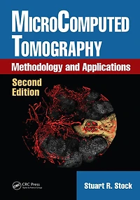MicroComputed Tomography: Methodology and Applications, Second Edition