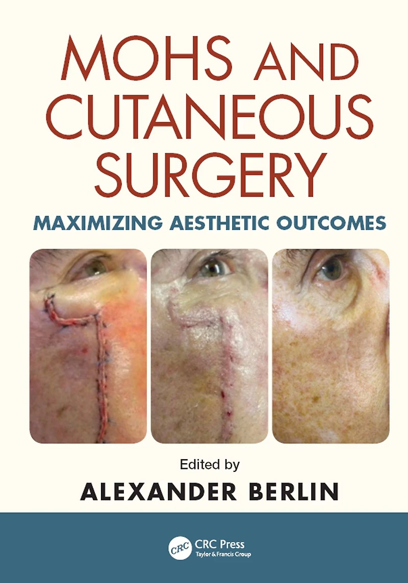 Mohs and Cutaneous Surgery: Maximizing Aesthetic Outcomes