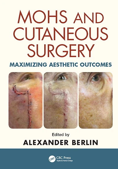 Mohs and Cutaneous Surgery: Maximizing Aesthetic Outcomes