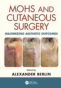 Mohs and Cutaneous Surgery: Maximizing Aesthetic Outcomes