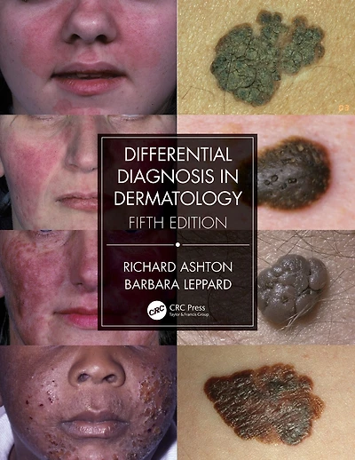 Differential Diagnosis Dermatology