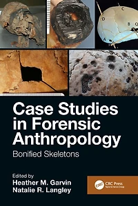 Case Studies Forensic Anthropology: Bonified Skeletons