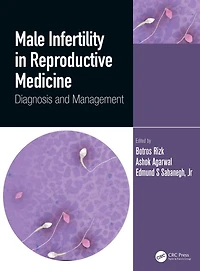 Male Infertility Reproductive Medicine: Diagnosis and Management