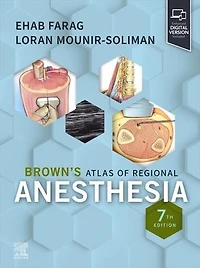 Brown's Atlas of Regional Anesthesia, E-Book