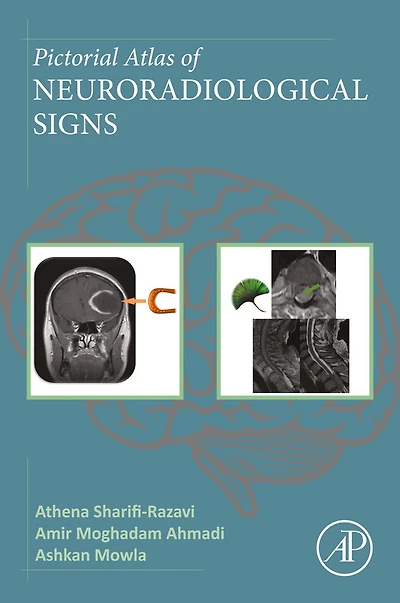 Pictorial Atlas of Neuroradiological Signs