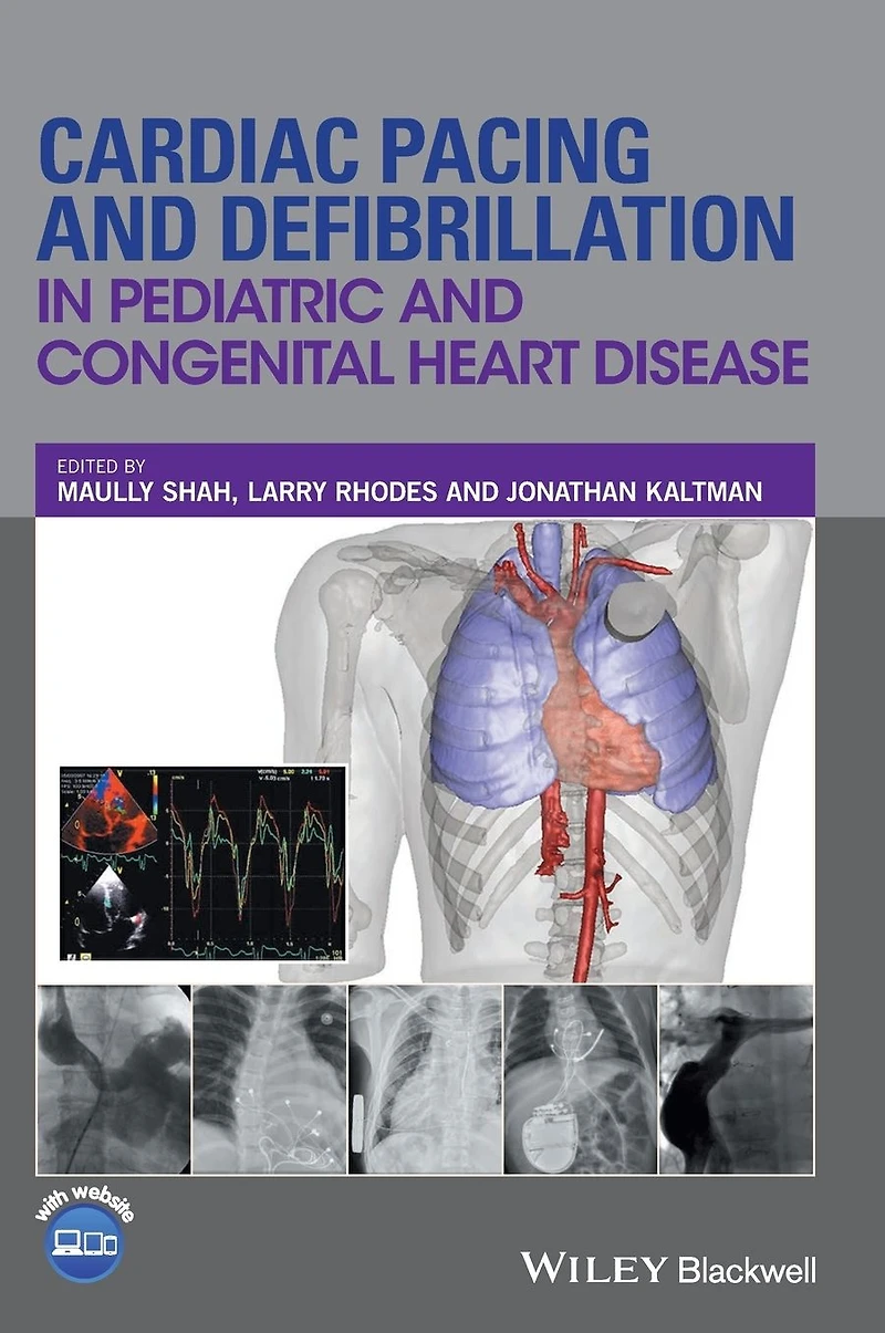 Cardiac Pacing and Defibrillation Pediatric Congenital Heart Disease