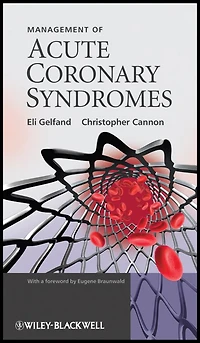 Management of Acute Coronary Syndromes
