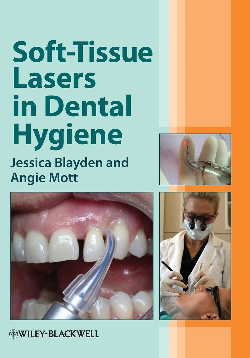 Soft-Tissue Lasers Dental Hygiene
