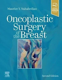 Oncoplastic Surgery of the Breast