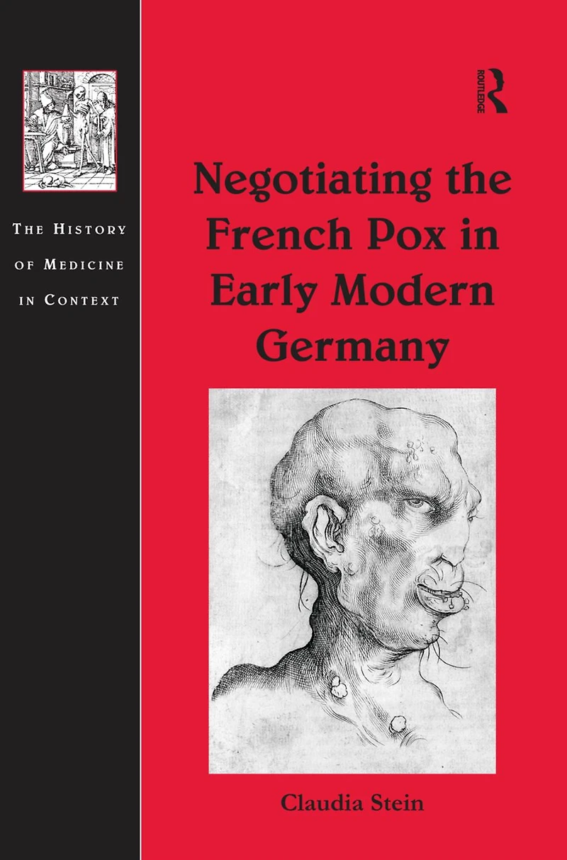 Negotiating the French Pox Early Modern Germany