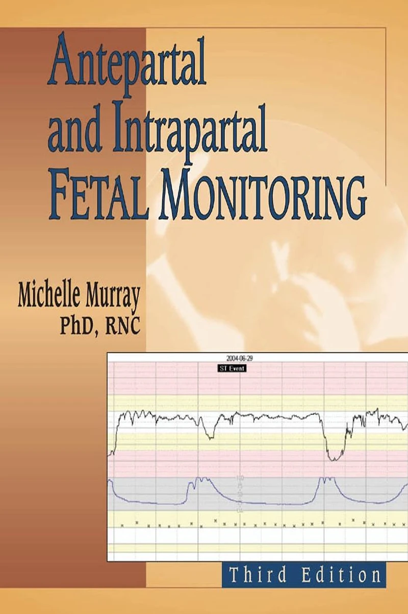 Antepartal and Intrapartal Fetal Monitoring: Third Edition