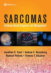 Sarcomas: Evidence-based Diagnosis and Management