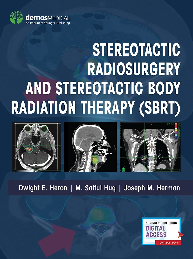Stereotactic Radiosurgery and Body Radiation Therapy (SBRT)
