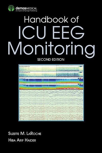 Handbook of ICU EEG Monitoring